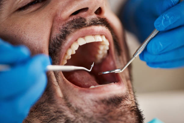 Best Emergency Dentist for Lost Fillings or Crowns in Ohioville, PA